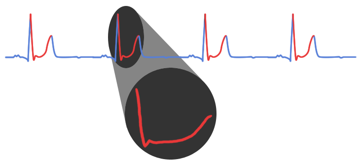 Heartbeat Chart 2
