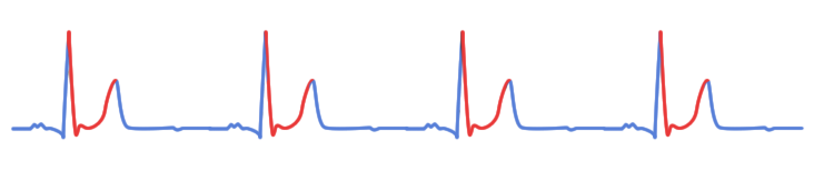 Heartbeat Chart